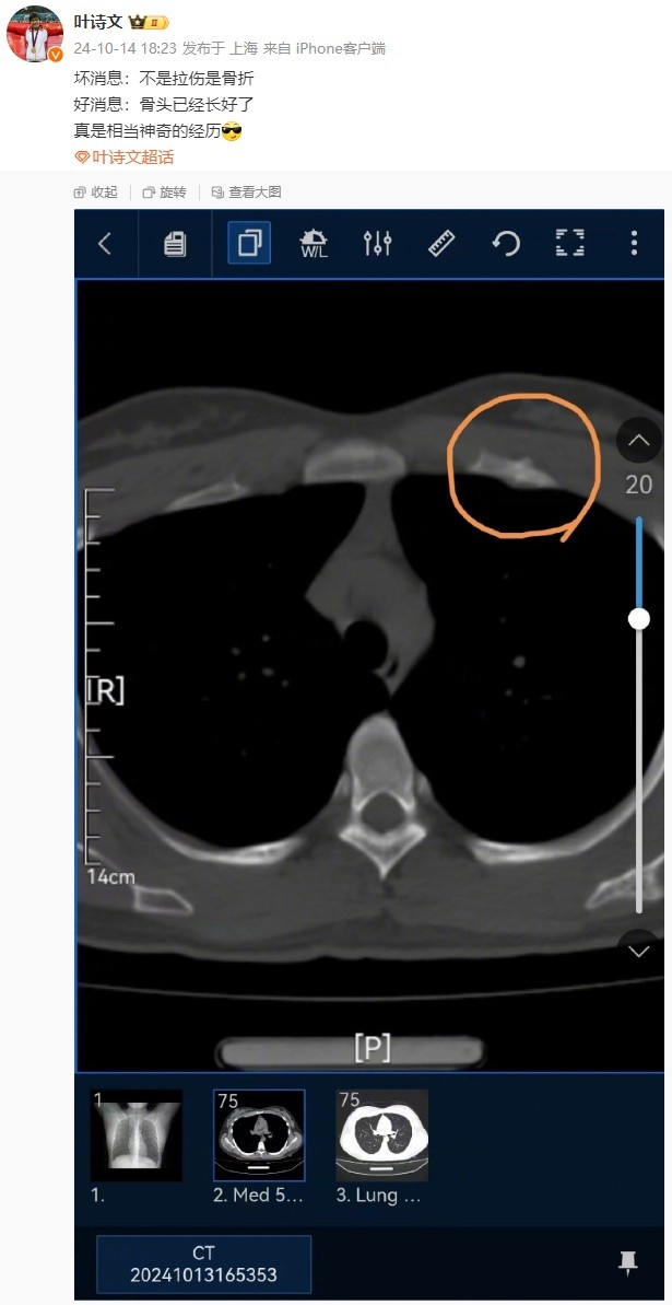 可惜!叶诗文将退出游泳世界杯上海站女子100米蛙泳比赛